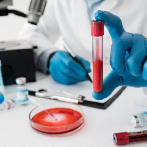 EXAMES DE SANGUE ALECRIM