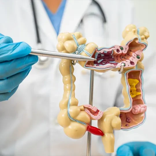 Médico de jaleco branco e luvas azuis utilizando um instrumento para apontar detalhes em um modelo anatômico de cólon humano (intestino grosso), demonstrando áreas internas do sistema digestivo.