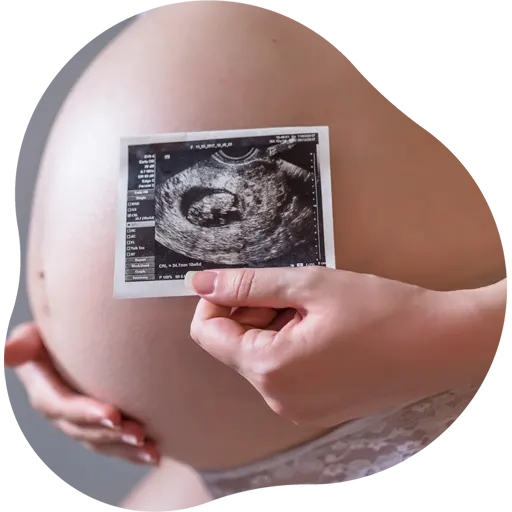 Monitor exibindo imagem de ultrassom de tireoide em alta definição em Vila Velha.