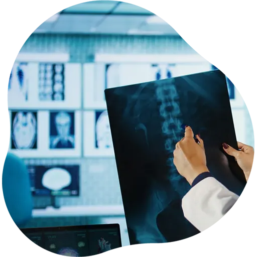 Médico radiologista analisando exame de Raio-X de tórax em Vila Velha.